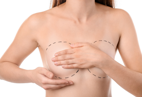 Breast Augmentation